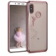 kwmobile Coque Xiaomi Redmi Note 5  Global Version  / Note 5 Pro - Coque pour Xiaomi Redmi Note 5  Global Version  / Note 5 P